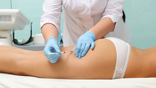 What is Carboxytherapy and How Does it Fight Cellulite?