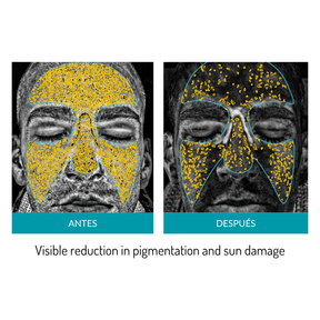 Glo Mask Anti-Aging LED Phototherapy Mask
