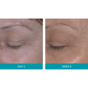 Glo Mask Anti-Aging LED Phototherapy Mask